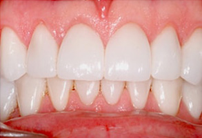 Dental Images in Forest Hills