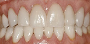 dental images 11375