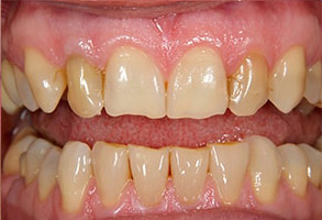 Forest Hills Dental Images